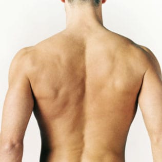 Depilación láser hombros espalda hombre